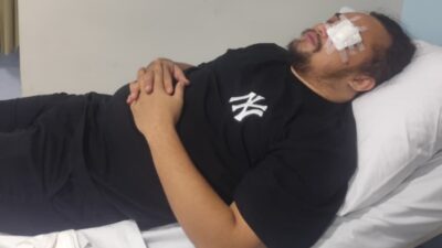 Amankan Tawuran, Anggota Polsek Bontoala Jadi Korban Petasan di Makassar