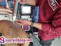 Bersatu Untuk Berbagi: Suara Imbang dan Mahtan Gelar Aksi Sosial Hapus Tatto dan Sunatan Massal